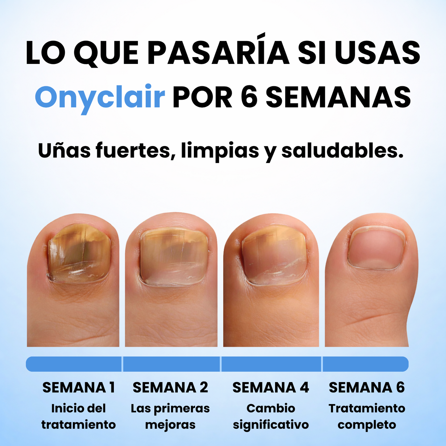 Onyclair® - Parches Naturales Para Tus Uñas